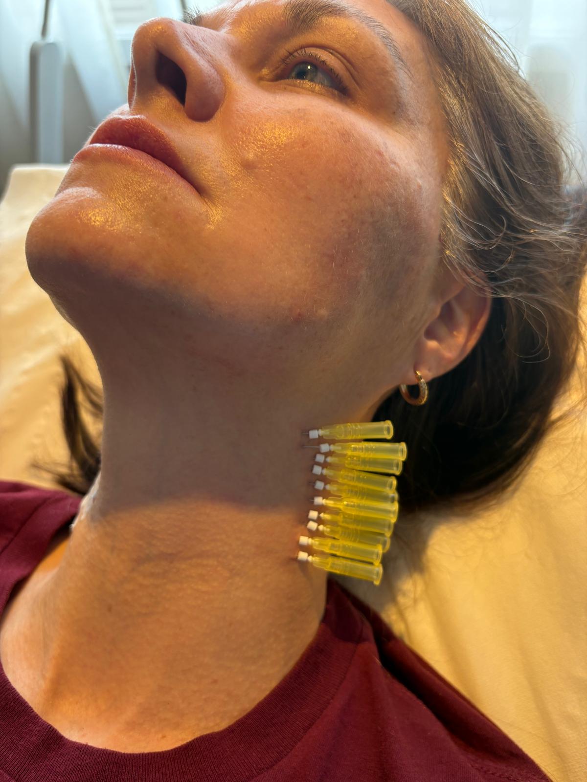 Fiona Russell performing a specialist facial treatment at AF13 Aesthetics